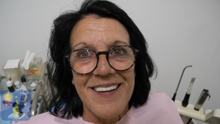 patiente de France pour restauration dentaire avec implant basal pour parodontite